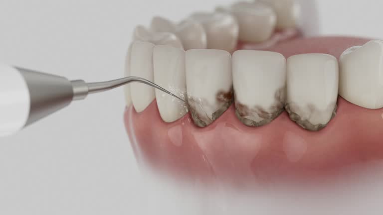 Trusted Wisdom Tooth Removal service in Red Springs, NC - Dentist Open Now